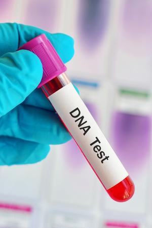 DNA Test Sample